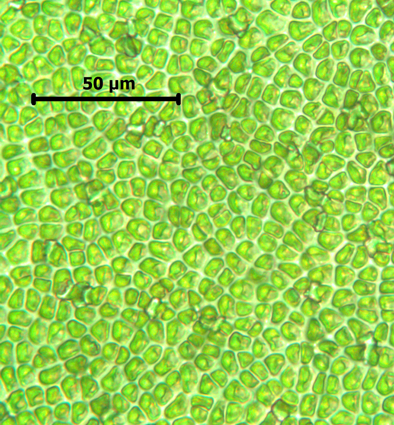 ulva under microscope